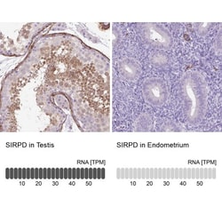 SIRP delta Antibody, Novus Biologicals:Antibodies:Primary Antibodies